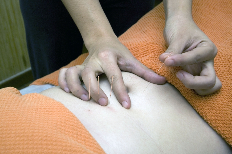 osteopathe-TENDE-min_acupuncture-4175625